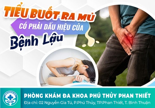 Tiểu ra mủ ở nam giới biểu hiện thế nào?