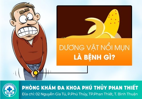 Nổi mụn trắng ở bao quy đầu