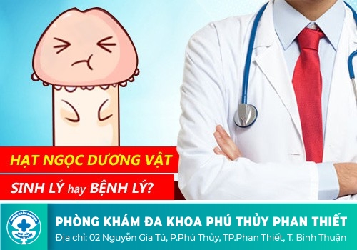 Chuỗi hạt ngọc dương vật là gì?