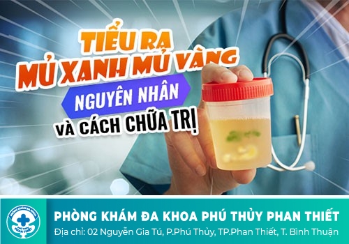 Nam giới đi tiểu rát tiết chất nhờn