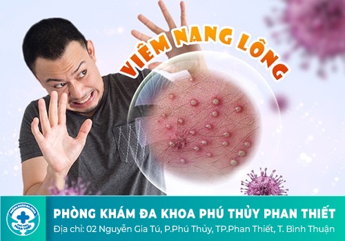 Bệnh nổi mụn ở bộ phận sinh dục nam