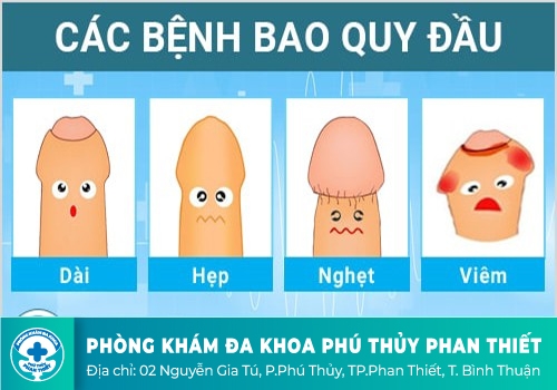 Những bệnh lý thường gặp tại rãnh quy đầu