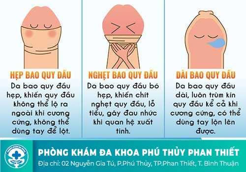 Các bệnh bao quy đầu bẩm sinh: 