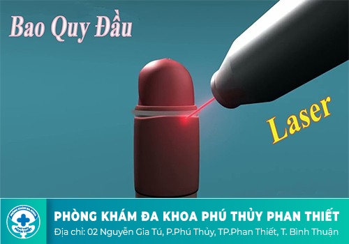 Quy trình và hiệu quả của phương pháp cắt bao quy đầu bằng Laser