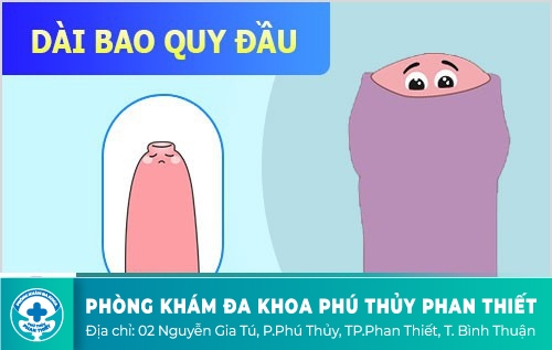 DÀI BAO QUY ĐẦU LÀ GÌ?