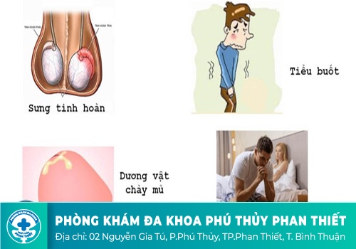 Đau dương vật khi quan hệ là dấu hiệu bệnh gì?