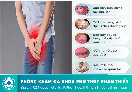 đau dương vật 
