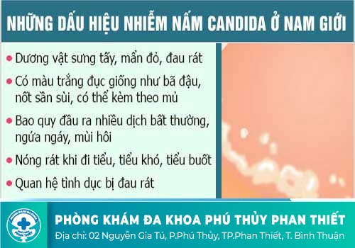 Nam giới và dấu hiệu mắc bệnh nấm Candida?