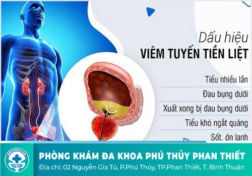 Làm sao nhận biết bệnh viêm tuyến tiền liệt chính xác?
