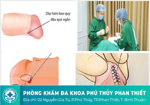 Nguyên nhân chảy máu dương vật sau khi quan hệ