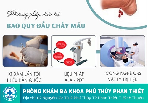 Điều trị bao quy đầu chảy máu nhanh chóng