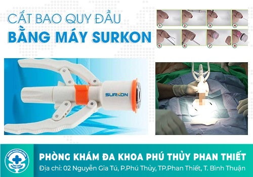 CẮT BAO QUY ĐẦU BẰNG CÁCH NÀO HIỆU QUẢ, AN TOÀN?