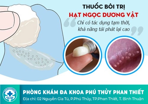 Đâu là giải pháp cho tình trạng xuất hiện hạt trắng dưới bao quy đầu ở nam giới 