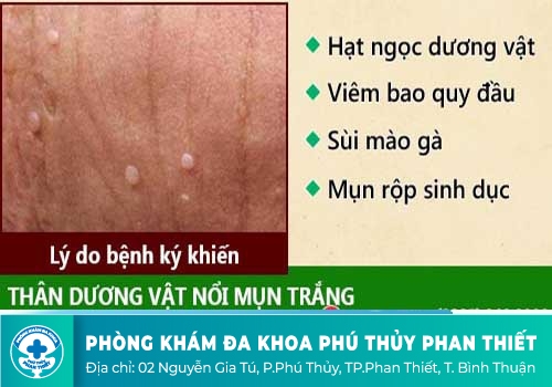 Nguyên nhân khiến nam giới bị nổi mụn trắng ở tinh hoàn
