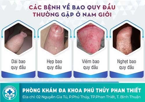 Bệnh về bao quy đầu do nguyên nhân bệnh lý: 