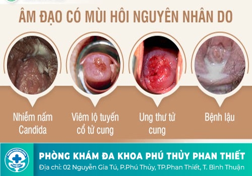 Biểu hiện tố cáo tình trạng hôi vùng kín ở nam và nữ