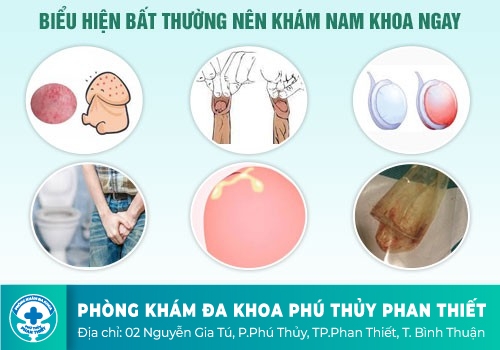 Chữa viêm bao quy đầu hiệu quả