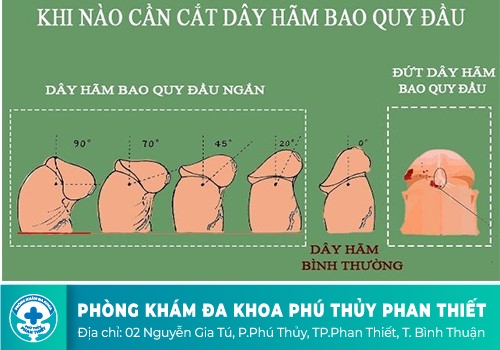 DÂY HÃM BAO QUY ĐẦU LÀ GÌ
