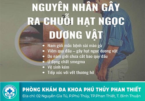 Nguyên nhân gây nên tình trạng hạt trắng dưới bao quy đầu?