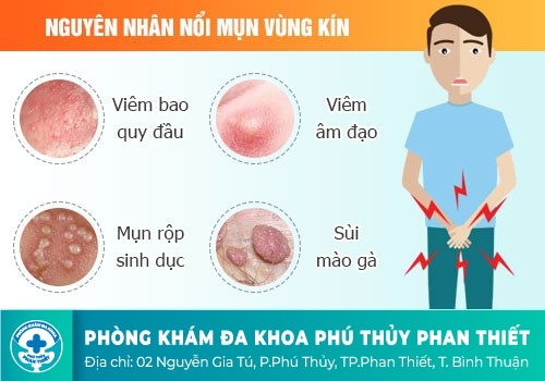 Bao quy đầu nổi mụn là bệnh gì?