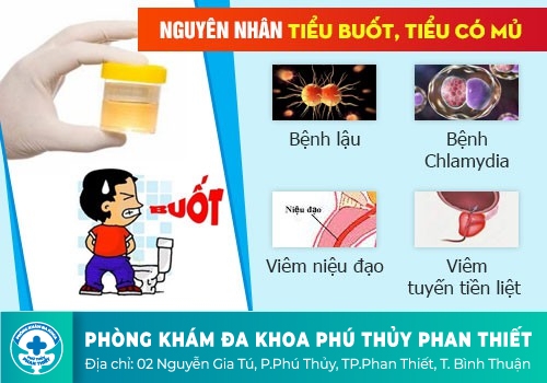 tình trạng tiểu rắt, tiểu buốt ra máu ở nam giới