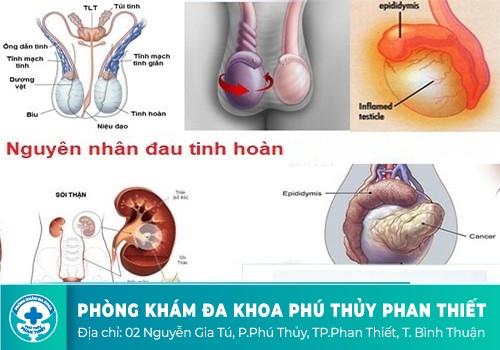 Nguyên nhân gây đau 1 bên tinh hoàn