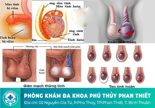  đau tinh hoàn 1 bên, đau 2 bên có nguy hiểm gì không?  