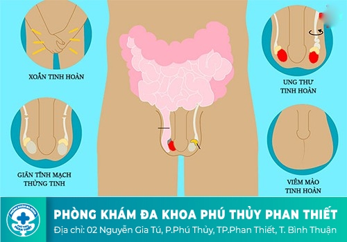 Đau tinh hoàn nhưng không sưng