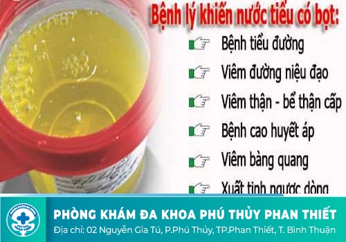 Vậy bạn có biết nước tiểu có bọt là bệnh gì?