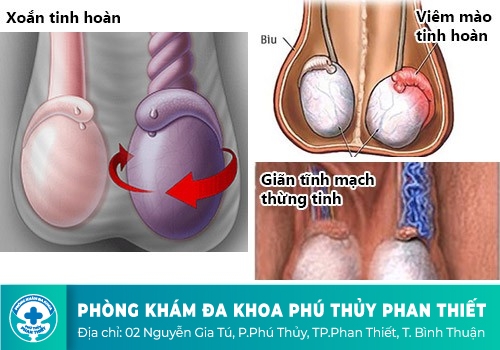 Các bệnh tinh hoàn nam giới thường gặp