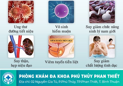 Viêm niệu đạo nguy hiểm thế nào