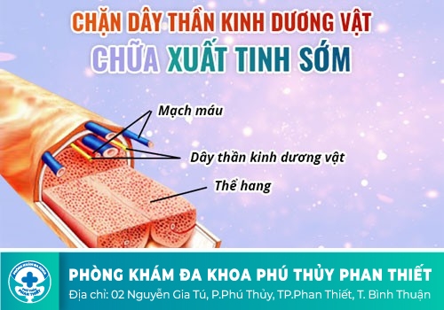 Phương pháp hỗ trợ kéo dài thời gian quan hệ hiệu quả