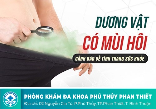Dương vật bị hôi liệu có phải là bệnh không?