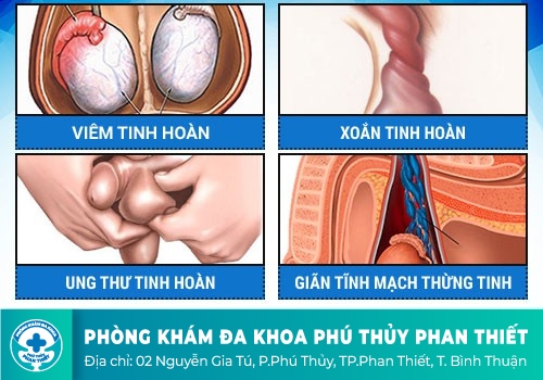 đau tức tinh hoàn ở nam giới