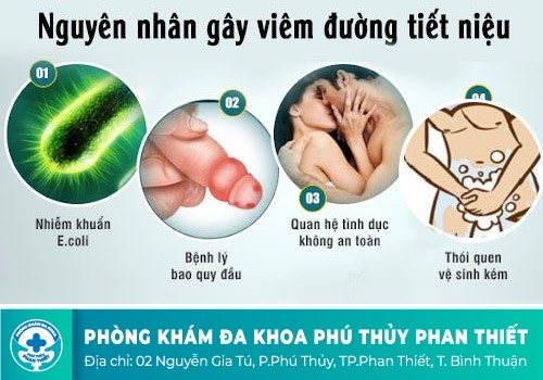 Dấu hiệu của viêm đường tiết niệu