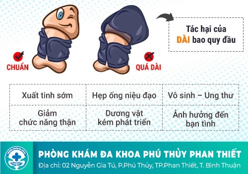 Bao quy đầu dài có phải cắt không?
