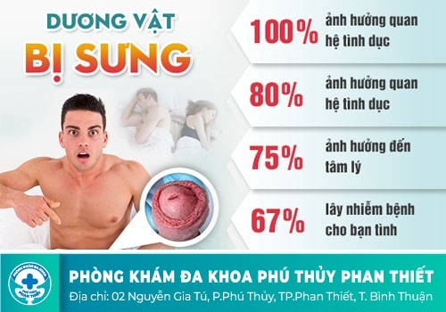 Dương vật bị phù nề, biểu hiện không nên chủ quan