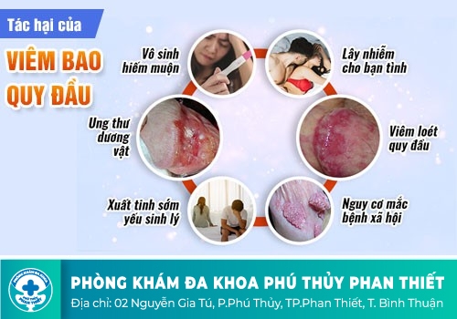 Nguyên nhân xuất hiện bợn trắng quy đầu