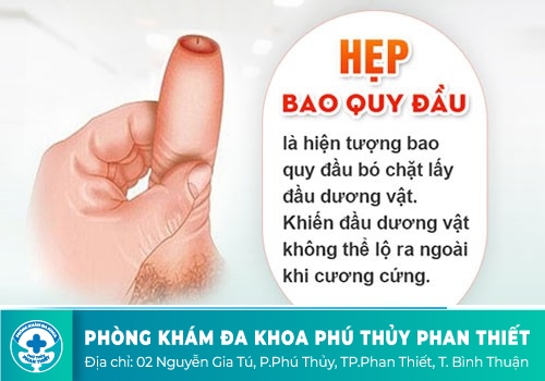 Quy đầu bị đau khi chạm vào là bệnh gì