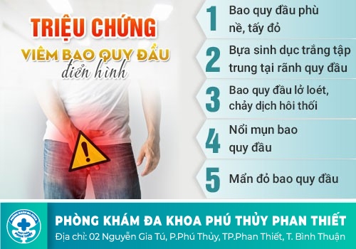 Viêm bao quy đầu