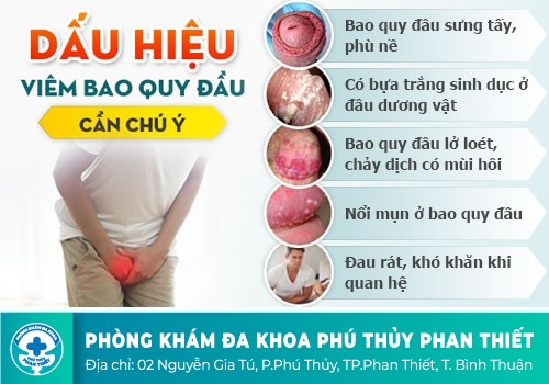 bệnh dương vật hay gặp ở nam giới
