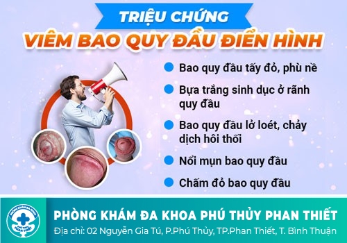 Các bệnh về dương vật thường gặp