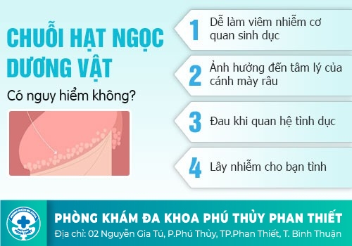 Chuỗi hạt ngọc dương vật có nguy hiểm và ảnh hưởng đến quan hệ tình dục không?