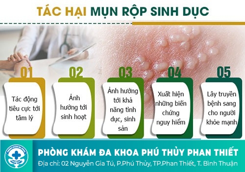 Dương vật nổi mụn li ti liệu có phải là bệnh?