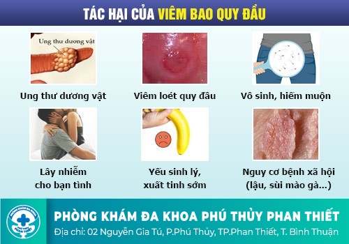 Quy đầu bị đau khi chạm vào có nguy hiểm không?