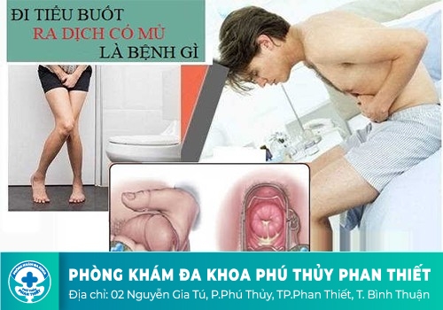 Đi Tiểu Bị Buốt Đường Tiểu, Tại Sao