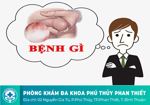 Tiểu buốt, tiểu rắt, tiểu có mủ