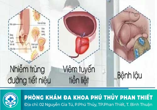 tình trạng tiểu rắt ở nam giới