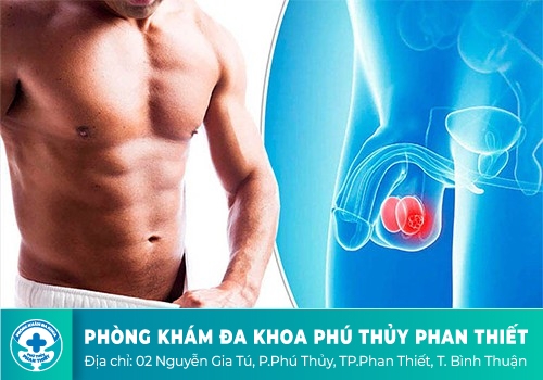 sưng vùng bìu ở nam giới