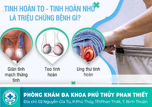 Nam giới bị teo tinh hoàn do đâu?